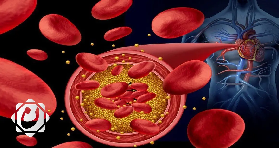 أعراض غير تقليدية لتصلب الشرايين: انتبه لها!