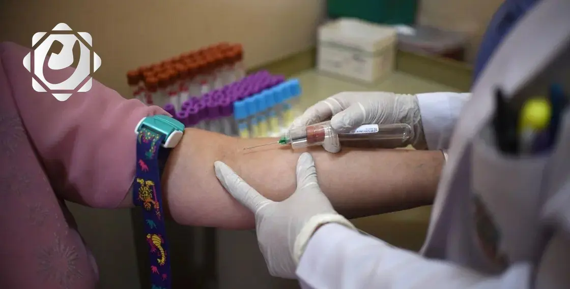 دراسة جديدة تكشف العلاقة بين الصدفية وأمراض الأمعاء