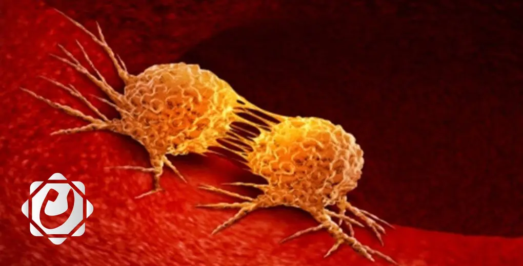 دراسة تكشف عن طرق فعالة للحد من خطر الإصابة بالسرطان