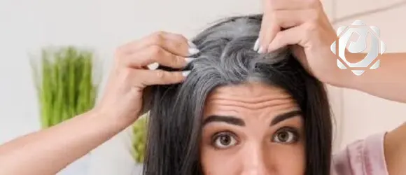 أسباب الشيب المبكر وفقًا لأطباء الجلد