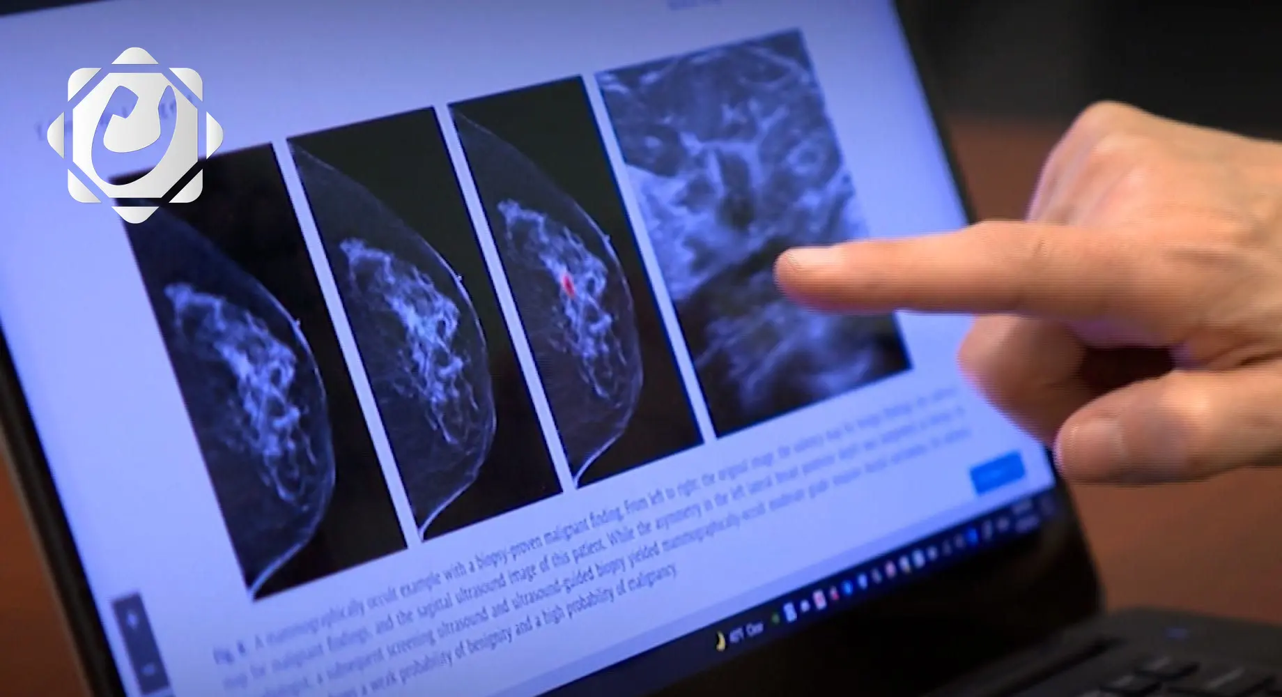 دراسة جديدة تربط بين الوشم وزيادة خطر الإصابة بالسرطان