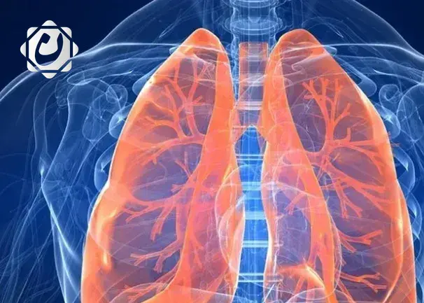 أبحاث جديدة: نمط الحياة غير الصحي يعزز خطر الإصابة بالانسداد الرئوي المزمن