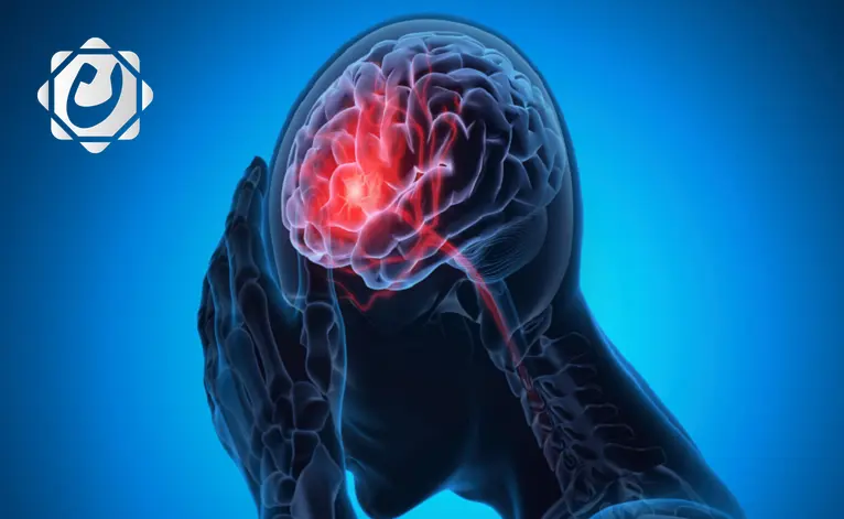 5 خطوات بسيطة للوقاية من السكتة الدماغية وتحسين صحة الدماغ