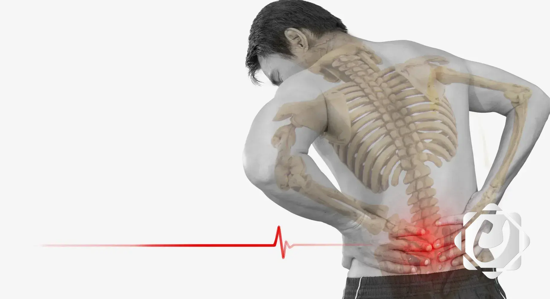 علاج مبتكر لآلام أسفل الظهر المزمنة من جامعة ماكغيل