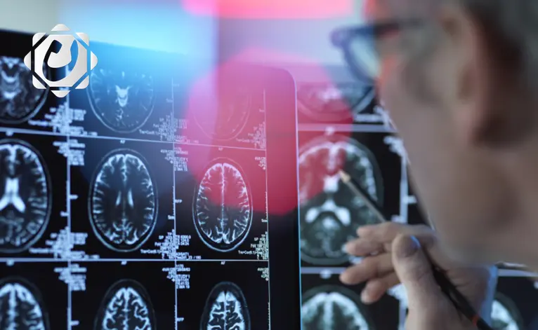 دراسة تكشف: فيروس شائع يزيد من خطر الإصابة بالخرف المبكر