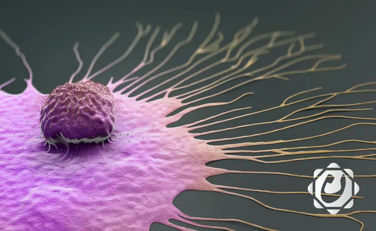 زيادة الوزن وتأخر الإنجاب: عوامل تؤدي إلى ارتفاع خطر سرطان الثدي