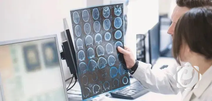 اختبار دم مبتكر لتشخيص الزهايمر يفتح آفاق العلاج المبكر