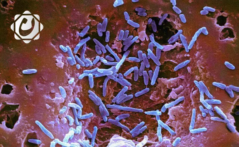 اكتشاف بكتيريا معوية تعزز فعالية العلاج المناعي للسرطان