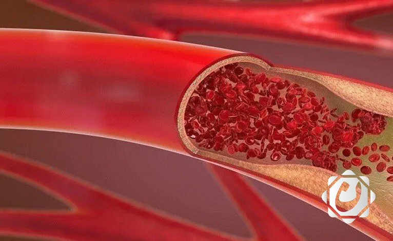 دراسة: الدهون الحشوية تعجل بعملية شيخوخة القلب