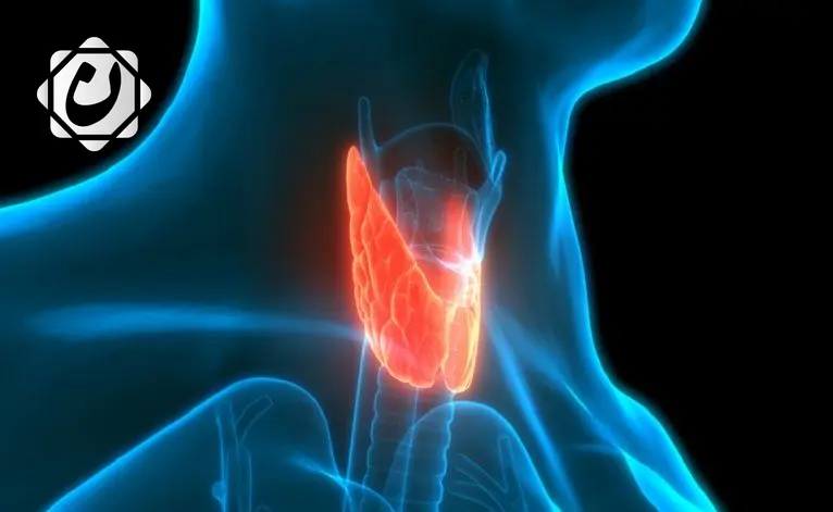 نصائح غذائية لتخفيف أعراض اضطرابات الغدة الدرقية