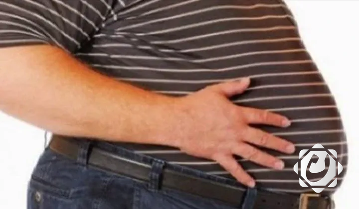 دراسات تحذر: السمنة تزيد من معدلات الوفاة بسبب الأمراض المعدية